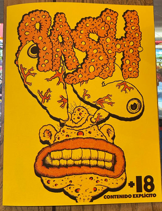 Rash #1